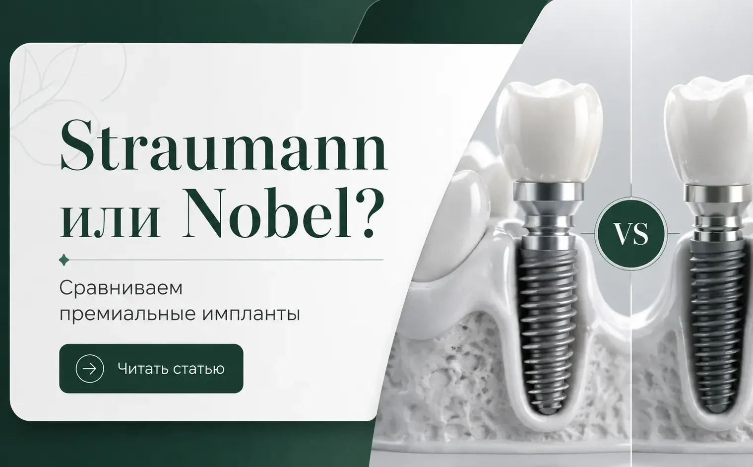 Имплантат Straumann или Nobel? Как выбрать?